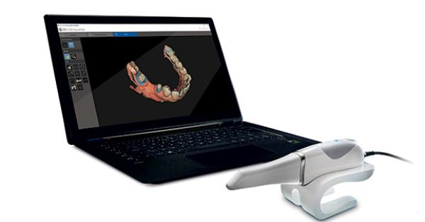3600 intra oral scanner