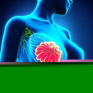 blue lymph breast